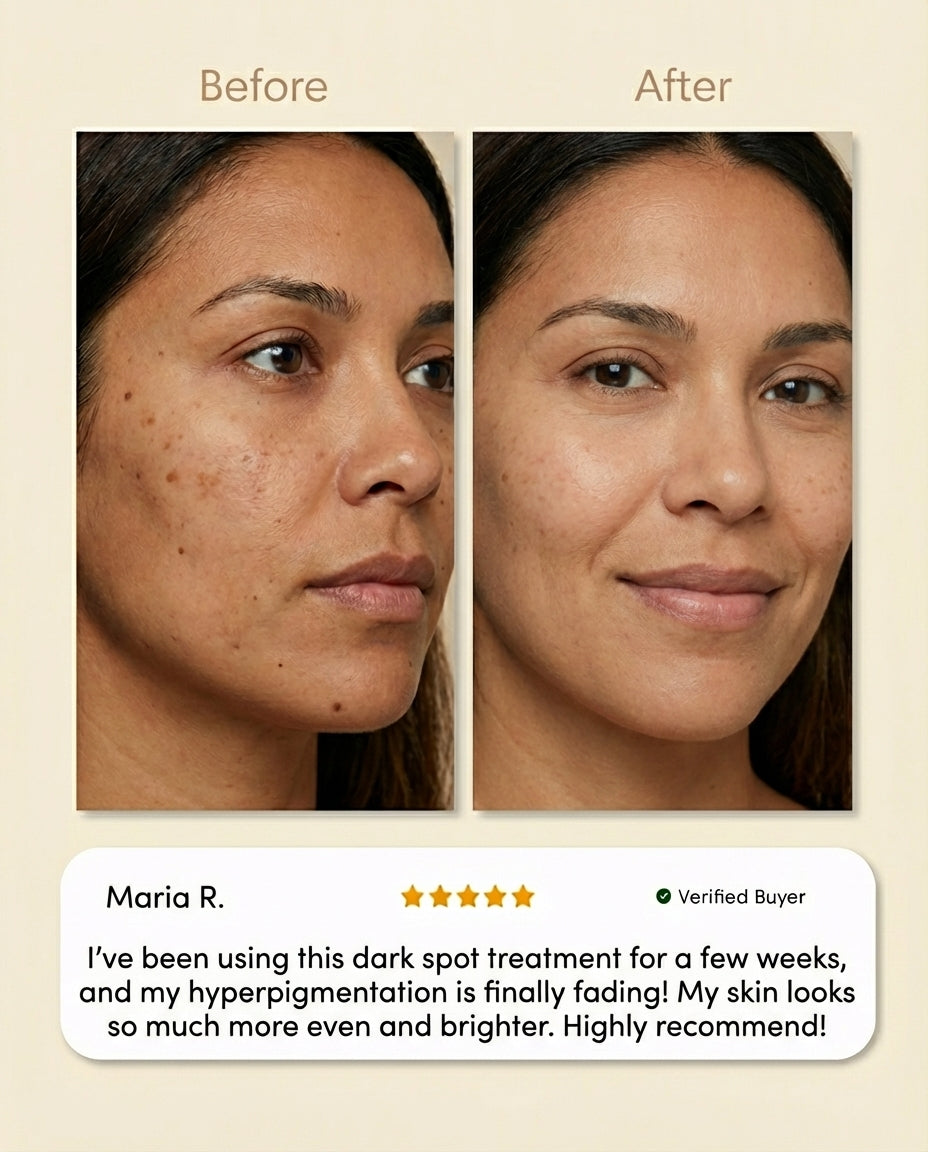 Dark Spot Corrector Serum – 1% Kojic Acid Brightening Formula