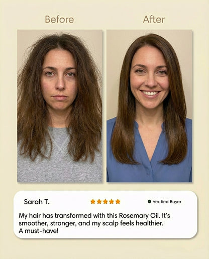 Rosemary Scalp Treatment Oil – Strengthen Roots &amp; Restore Shine